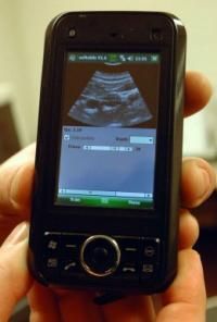 Windows Mobile can help check for babies, might even help you make them